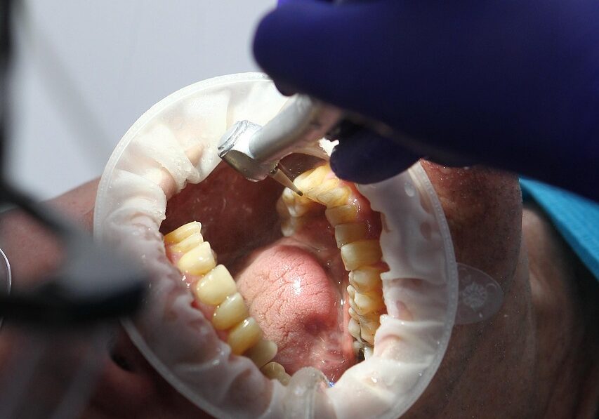 dentist, oral health, dental health, oral hygiene, dental hygiene, teeth, teeth cleaning, teeth whitening, dentist, dentist, dentist, dentist, dentist, oral health, dental health, teeth, teeth, teeth cleaning, teeth cleaning, teeth whitening, teeth whitening, teeth whitening